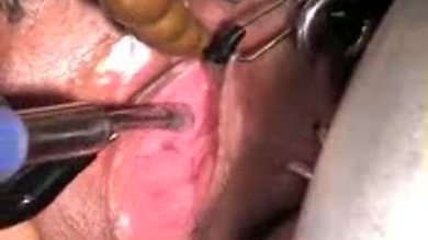 Femme masochiste réelle dans la stimulation électrique hardcore. - xhamster.com